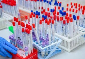 Медработники в Москве проходят экспресс-тесты на иммунитет к COVID-19. Фото: сайт мэра Москвы